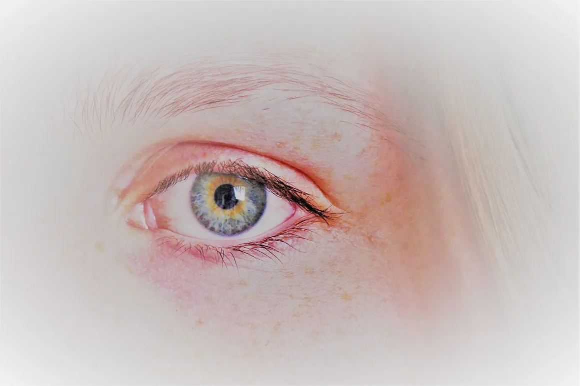 Close up of an eye representing EMDR eye movement therapy